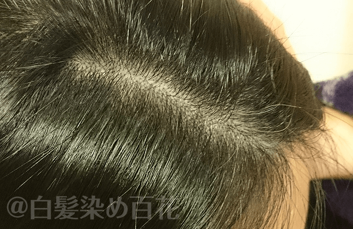 利尻昆布トリートメントの使用2回目